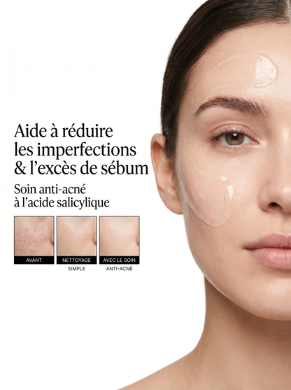 SOINS ANTI-ACNÉ